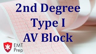 2nd Degree Type 1 AV Block ECG  EMTprepcom [upl. by Gowrie]