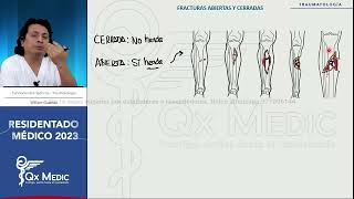 RM 2023 Traumatología 5 Fracturas Generalidades [upl. by Linnet]