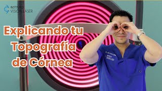 EXPLICANDO TU TOPOGRAFIA DE CORNEA [upl. by Artened356]