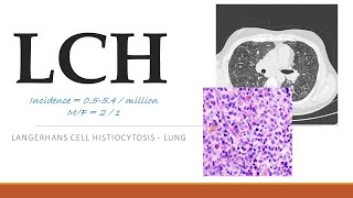 LCH  Unraveling LANGERHANS CELL HISTIOCYTOSIS A Comprehensive Guide [upl. by Chrissa]