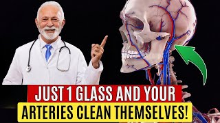 Russian Doctor Only THIS Remedy Cleans Arteries of Plaques and Clots in 7 Days [upl. by Helbonnas]