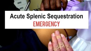 Sickle Cell Splenic Sequestration Emergency [upl. by Anaynek]