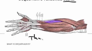 De Quervain Tendonitis Basics Like Its Just Thumb Tendonitis [upl. by Aihsekal]