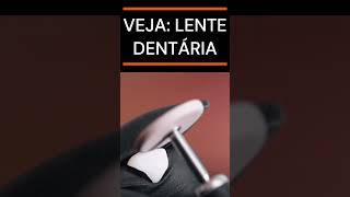 LENTE DENTÁRIA NA PRÁTICA  bucal dentistasp shortsfeed odonto dentist dentes orthodontist [upl. by Lalla]