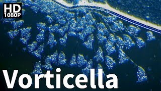 Vorticella Under Microscope [upl. by Polky]