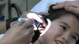 Awake Ear Tube Placement In Children [upl. by Finny]