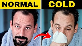 Common Cold Treatment in Hindi  Medicine Symptoms  Home Remedy [upl. by Inger380]