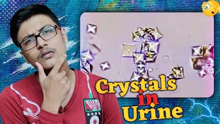 पेशाब में यह क्रिस्टल क्या है  What is This Crystal in Urine  J2 Ke Factz shorts [upl. by Aniahs]