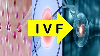 InVitroFertilization IVF Process [upl. by Enyaht]