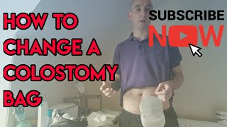 How to change a colostomy stoma bag [upl. by Irbua]