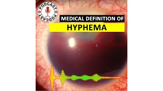 Hyphema Medical Definition of Hyphema Podcast [upl. by Onileva714]