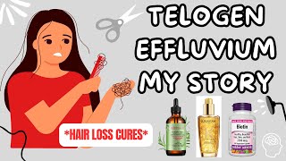 Telogen Effluvium Recovery  REGROWTH TIPS [upl. by Eneleahcim]