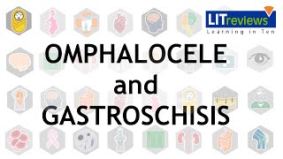 Omphalocele and Gastroschisis [upl. by Atyekram]