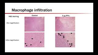 Dr Lauren Wood Sustained Release InterferonGamma M1 tumorassociated macrophages [upl. by Tessy]