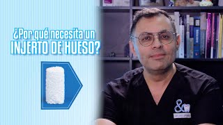 ¿POR QUÉ NECESITA UN INJERTO DE HUESO [upl. by Erlin]