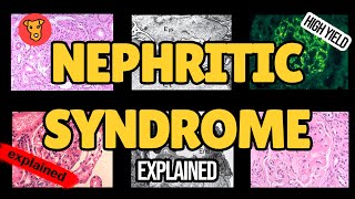 NEPHRITIC SYNDROME Pathogenesis of glomerular injury Mechanism of clinical symptoms USMLE Nephrology [upl. by Abbie522]