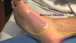 Motorische Neurographie  Tibialis [upl. by Downing820]