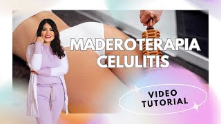 MADEROTERAPIA CELULITIS PIENAS [upl. by Reivad]