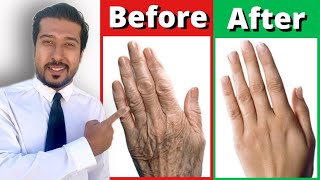 2 Fast Remedies for Dry and Wrinkled Hands THAT WORK [upl. by Aesoh]