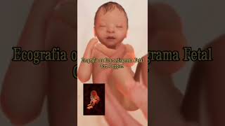 28 weeks pregnancy journey baby viralvideo [upl. by Syst]