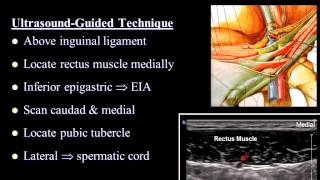 Pain Medicine  Ilioinguinal Nerve Iliohypogastric Nerve Inguinal Canal TAP [upl. by Florina]