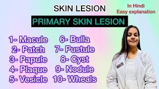 primary skin lesions lecture in Hindi with easy explanation [upl. by Sonitnatsnok]