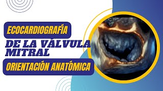 🔎ECOCARDIOGRAFÍA DE LA VÁLVULA MITRAL ❤️‍🔥Orientación Anatómica 4D [upl. by Baird]