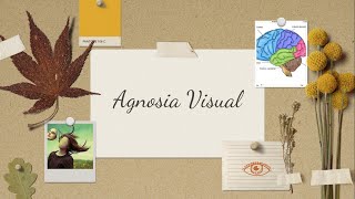 Agnosia Visual [upl. by Azmuh]