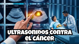 Ultrasonido El Futuro de la Detección del Cáncer [upl. by Yddub]