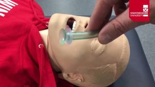 Nasopharyngeal Airway Insertion [upl. by Peggie]