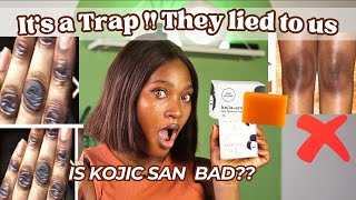 WHY KOJIC SAN SOAP IS NOT WORKING FOR YOU  HOW TO SPOT THE FAKE  Do’s amp Don’t [upl. by Wahkuna]