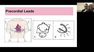 ECG Interpretation Parts 1 amp 2 Dr D Zorko Clinical Scholar McMaster Childrens Hospital PICU [upl. by Bev]