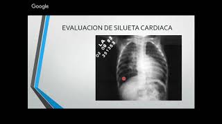 Imagenologia de la patologia cardiaca [upl. by Fulbright]