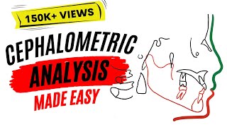 Cephalometric analysis [upl. by Canica]