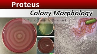 Proteus Colony Morphology  Clear Explain [upl. by Eidnar329]