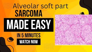 Alveolar soft part sarcoma [upl. by Dorsey56]