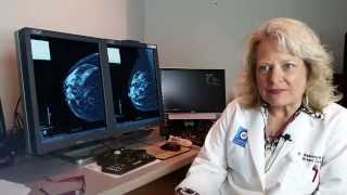 Mercy Offers New 3D Tomosynthesis Mammography [upl. by Haorbed712]