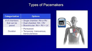 An Introduction to Pacemakers [upl. by Tsan]