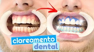 Tudo sobre meu clareamento dental dúvidas e como funciona clarear os dentes 😬💉 [upl. by Nylhtiak]