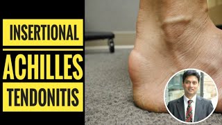 Insertional Achilles Tendinitis How to Diagnose [upl. by Esilehs]