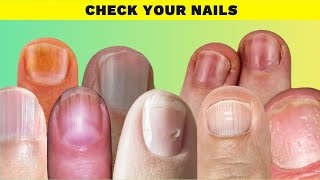 Unlocking the Secrets 9 Things Your Nails Reveal About Your Health [upl. by Spillar810]