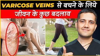 Treatment Of Varicose Veins Became Easy With Lifestyle Changes  Dr Gaurav Gangwani IR [upl. by Cristal48]