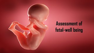 ASSESSMENT OF FETAL WELLBEING II SELSAMS II HINDI [upl. by Rozelle322]