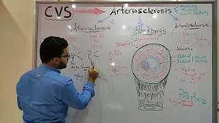 CVS MODULE  Atherosclerosis [upl. by Aikemot]