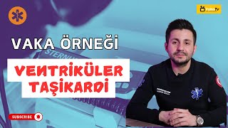 VAKA ÖRNEĞİ Ventriküler Taşikardi Geniş QRSli Taşikardi [upl. by Ellebasi795]