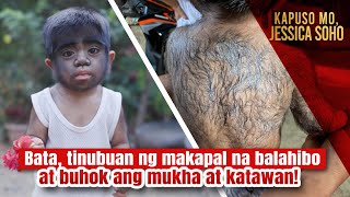 Bata tinubuan ng makapal na balahibo at buhok ang mukha at katawan  Kapuso Mo Jessica Soho [upl. by Vrablik]