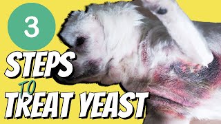 Top 3 Steps to Stop the Itching caused by Yeast [upl. by Yruoc]