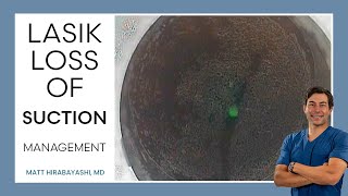 Suction Loss During LASIK Flap Creation VISUMAX [upl. by Talbert]