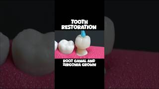 Tooth Restoration  Root Canal  Zirconia Crown ©️ CTTO RelaxingVideos satisfyingvideos [upl. by Sirovart]