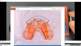 Orthodontic applience wire bending Z spring demo [upl. by Attelrac]